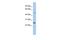 Chymotrypsinogen B1 antibody, GTX47747, GeneTex, Western Blot image 