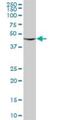 RuvB Like AAA ATPase 2 antibody, H00010856-B01P, Novus Biologicals, Western Blot image 