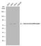 Nuclear Receptor Subfamily 3 Group C Member 1 antibody, GTX634647, GeneTex, Western Blot image 