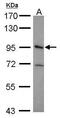 Integrin Subunit Beta 5 antibody, PA5-27759, Invitrogen Antibodies, Western Blot image 