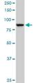 SEC63 Homolog, Protein Translocation Regulator antibody, H00011231-B01P, Novus Biologicals, Western Blot image 