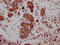 SUZ12 Polycomb Repressive Complex 2 Subunit antibody, CSB-RA159561A0HU, Cusabio, Immunohistochemistry frozen image 