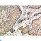 Napsin A Aspartic Peptidase antibody, LS-C813909, Lifespan Biosciences, Immunohistochemistry paraffin image 