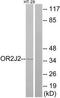 Olfactory Receptor Family 2 Subfamily J Member 2 antibody, TA315347, Origene, Western Blot image 