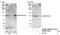 SWI/SNF Related, Matrix Associated, Actin Dependent Regulator Of Chromatin, Subfamily A Like 1 antibody, NB100-81640, Novus Biologicals, Western Blot image 