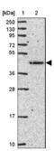 Fucosyltransferase 10 antibody, NBP2-31571, Novus Biologicals, Western Blot image 