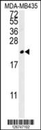 Triggering Receptor Expressed On Myeloid Cells 2 antibody, 61-940, ProSci, Western Blot image 