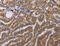 ALG9 Alpha-1,2-Mannosyltransferase antibody, LS-C401220, Lifespan Biosciences, Immunohistochemistry paraffin image 