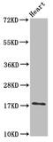 Ubiquitin Conjugating Enzyme E2 L3 antibody, CSB-PA025463LA01HU, Cusabio, Western Blot image 