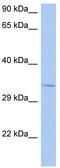 NSF Attachment Protein Beta antibody, TA330008, Origene, Western Blot image 