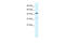 Potassium Voltage-Gated Channel Subfamily A Regulatory Beta Subunit 3 antibody, ARP35151_T100, Aviva Systems Biology, Western Blot image 