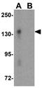 Zinc Finger E-Box Binding Homeobox 2 antibody, GTX85180, GeneTex, Western Blot image 