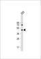 AlkB Homolog 5, RNA Demethylase antibody, GTX01525, GeneTex, Western Blot image 