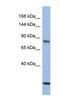 Mitogen-Activated Protein Kinase Kinase Kinase 11 antibody, NBP1-58913, Novus Biologicals, Western Blot image 