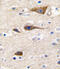 Cytochrome P450 Family 2 Subfamily R Member 1 antibody, 63-274, ProSci, Immunohistochemistry paraffin image 