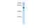 Transcription Factor AP-2 Beta antibody, 28-838, ProSci, Western Blot image 