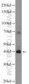 SLAIN Motif Family Member 1 antibody, 22123-1-AP, Proteintech Group, Western Blot image 