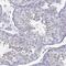 Testis Expressed 14, Intercellular Bridge Forming Factor antibody, NBP2-62709, Novus Biologicals, Immunohistochemistry paraffin image 