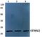 Stathmin 2 antibody, A04729, Boster Biological Technology, Western Blot image 