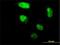 Zinc Finger Protein 213 antibody, H00007760-M02, Novus Biologicals, Immunocytochemistry image 