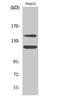 c-Kit antibody, P01335, Boster Biological Technology, Western Blot image 