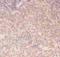 Component Of Inhibitor Of Nuclear Factor Kappa B Kinase Complex antibody, LS-C343976, Lifespan Biosciences, Immunohistochemistry paraffin image 