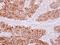 Phosphatidylinositol Transfer Protein Beta antibody, LS-C155595, Lifespan Biosciences, Immunohistochemistry paraffin image 