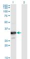 Myozenin 2 antibody, H00051778-M02, Novus Biologicals, Western Blot image 