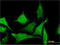 Tubulin Folding Cofactor C antibody, LS-C198305, Lifespan Biosciences, Immunofluorescence image 