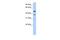 MAGE Family Member A3 antibody, PA5-42820, Invitrogen Antibodies, Western Blot image 