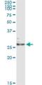 Ephrin A3 antibody, H00001944-M02, Novus Biologicals, Immunoprecipitation image 