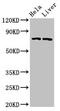 Acyl-CoA Synthetase Long Chain Family Member 5 antibody, CSB-PA891734HA01HU, Cusabio, Western Blot image 