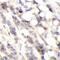 Ecdysoneless Cell Cycle Regulator antibody, FNab10368, FineTest, Immunohistochemistry paraffin image 