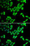 Thyroid Hormone Receptor Interactor 10 antibody, STJ29118, St John