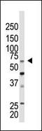 Chromobox 4 antibody, PA5-12199, Invitrogen Antibodies, Western Blot image 