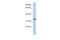 Membrane Spanning 4-Domains A4A antibody, A11806, Boster Biological Technology, Western Blot image 