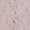 Rho Guanine Nucleotide Exchange Factor 25 antibody, NBP2-14309, Novus Biologicals, Immunohistochemistry frozen image 