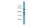 Dehydrogenase/Reductase 7B antibody, A15346, Boster Biological Technology, Western Blot image 