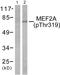 Myocyte Enhancer Factor 2A antibody, LS-C117410, Lifespan Biosciences, Western Blot image 