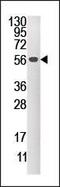 Dual Specificity Phosphatase 4 antibody, PA5-15549, Invitrogen Antibodies, Western Blot image 