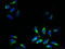 Solute Carrier Family 31 Member 2 antibody, A63438-100, Epigentek, Immunofluorescence image 