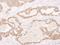 Glutathione S-transferase P 1 antibody, A303-628A, Bethyl Labs, Immunohistochemistry frozen image 