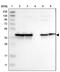 N-Acetylneuraminate Synthase antibody, PA5-53960, Invitrogen Antibodies, Western Blot image 