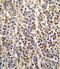 Aldehyde Dehydrogenase 1 Family Member A3 antibody, abx033713, Abbexa, Immunohistochemistry paraffin image 