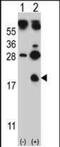 Hemoglobin Subunit Gamma 1 antibody, MBS642015, MyBioSource, Western Blot image 