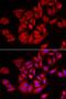 Serine/threonine-protein kinase tousled-like 2 antibody, LS-C334934, Lifespan Biosciences, Immunofluorescence image 