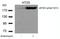 Eukaryotic Translation Initiation Factor 4 Gamma 1 antibody, GTX50344, GeneTex, Western Blot image 