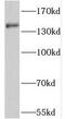 Patched 2 antibody, FNab06911, FineTest, Western Blot image 