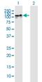 Zinc Finger Protein 710 antibody, H00374655-B01P, Novus Biologicals, Western Blot image 