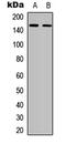 Colony Stimulating Factor 1 Receptor antibody, LS-C358957, Lifespan Biosciences, Western Blot image 